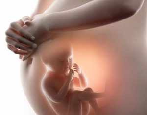 רשלנות רפואית בהריון – פיגור שכלי